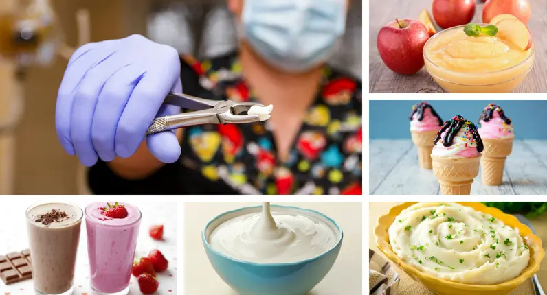 Foods That You Can Eat After Tooth Extraction