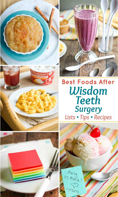 The Ultimate Guide to Deliciously Soft Foods to Eat After a Dental Surgery